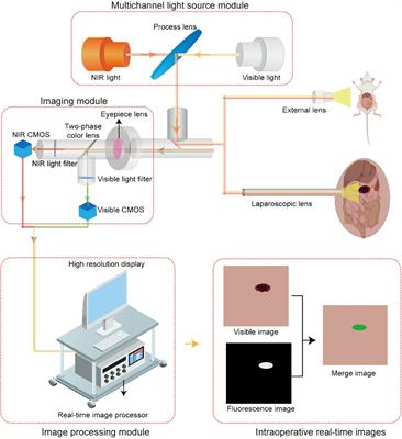 A preliminary investigation of precise visualization, localization, and resection of pelvic lymph nodes in bladder cancer by using indocyanine green fluorescence-guided approach through intracutaneous dye injection into the lower limbs and perineum